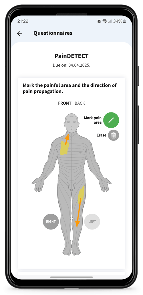 Pain Detect